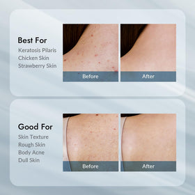 VILLAGE11FACTORY illustrative before and after result concept for smoother skin