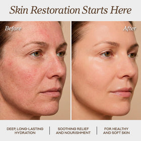 Vintage Tradition balm on cheek demonstrating gentle spot treatment benefit