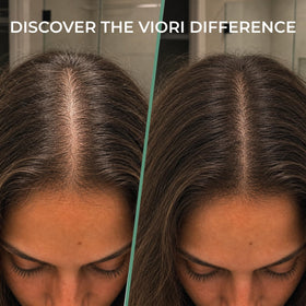 Viori bars beside a credit card showing compact, travel-friendly size