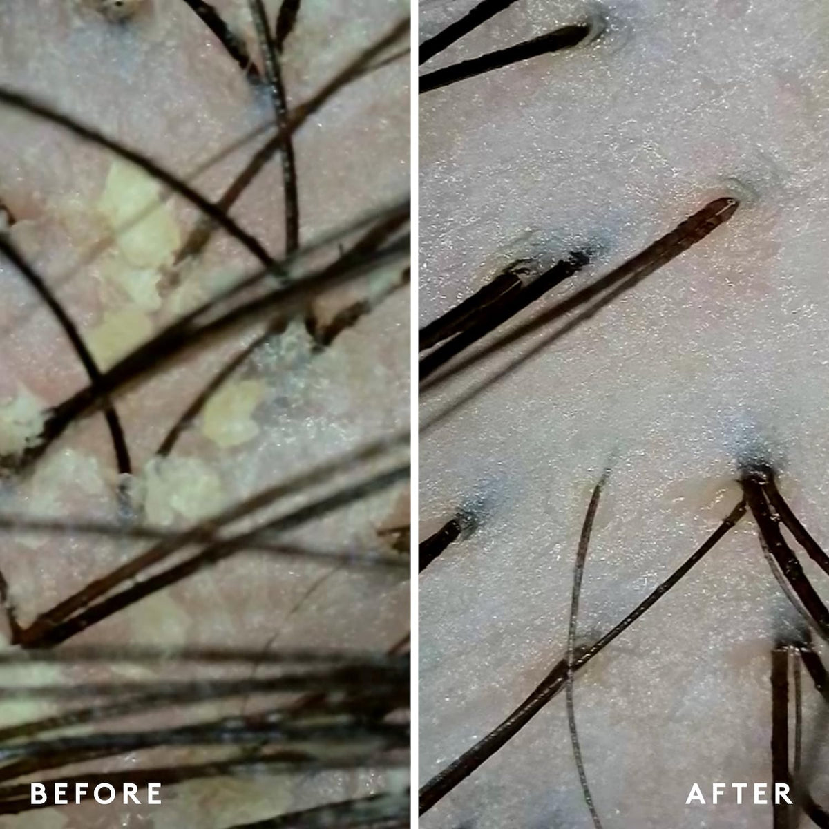 VIRTUE shampoo applied to wet hair demonstrating scalp massage benefit
