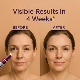 VitailQ neck and face comparison showing visible hydration benefit