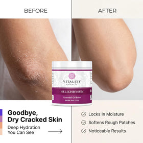 Person applying Vitality balm to hands demonstrating instant skin softening benefit