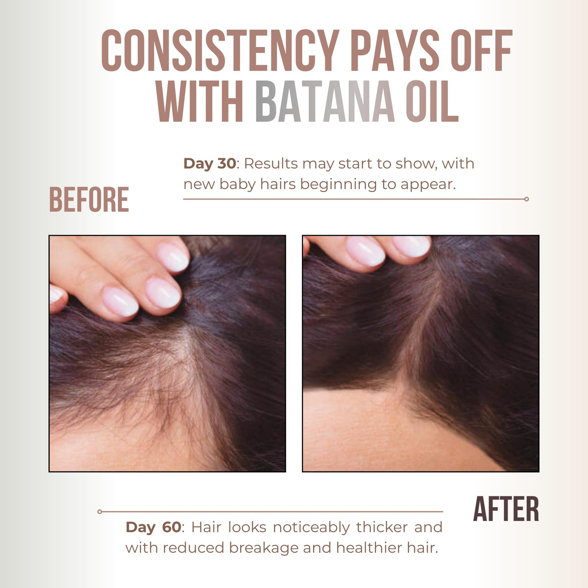 Vitamo hand applying oil to scalp, demonstrates gentle massage and moisture