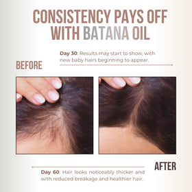 Vitamo hand applying oil to scalp, demonstrates gentle massage and moisture