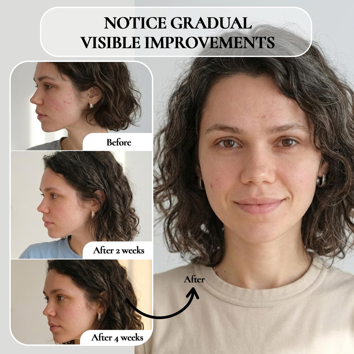 Vivo Per Lei application on hand illustrating easy massage removal