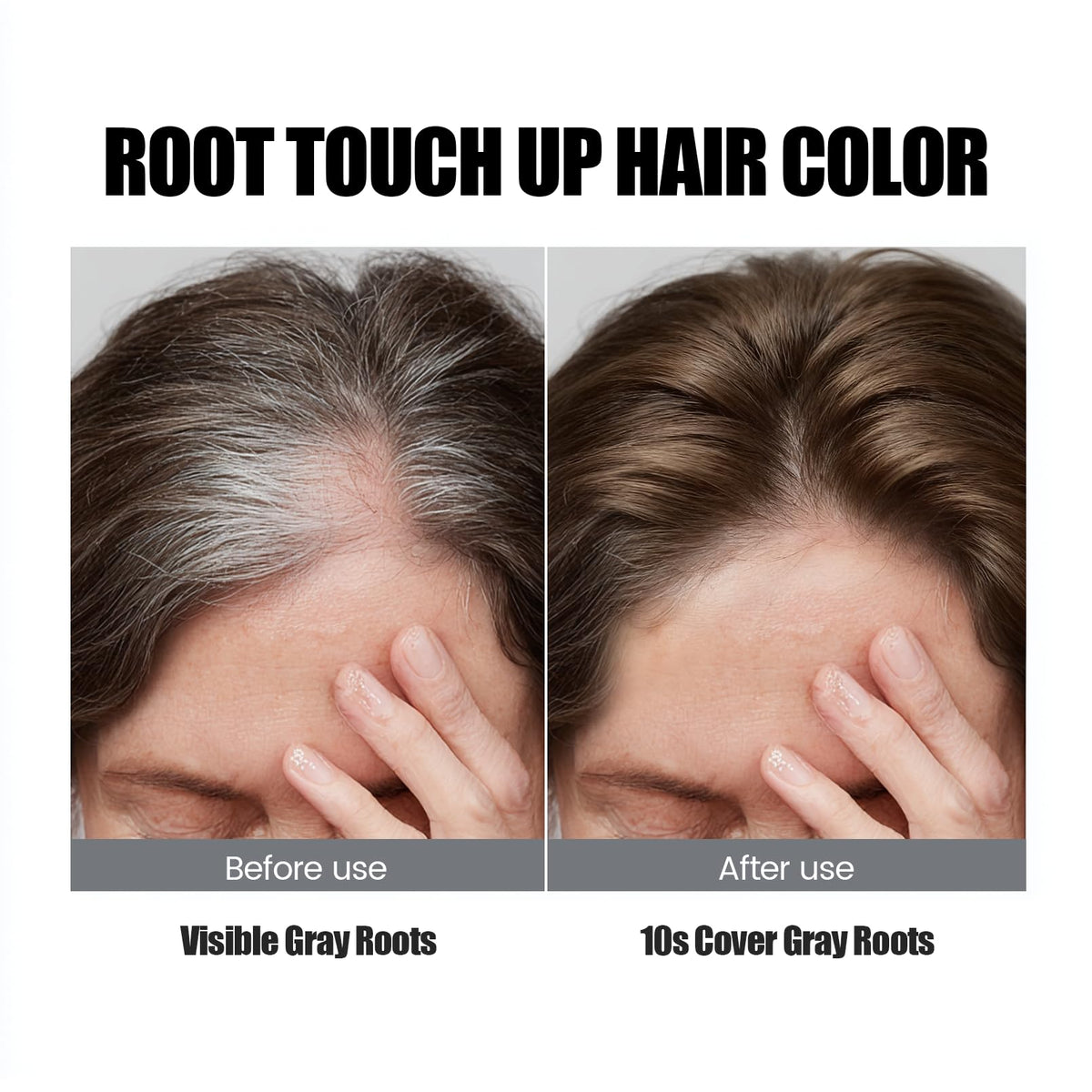 VOLLUCK before and after root coverage illustrating concealed thinning and added lift