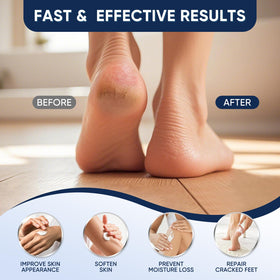 VREKEF before and after split showing smoother heels and reduced roughness