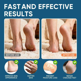 VREKEF being applied to heel demonstrating targeted callus care benefit