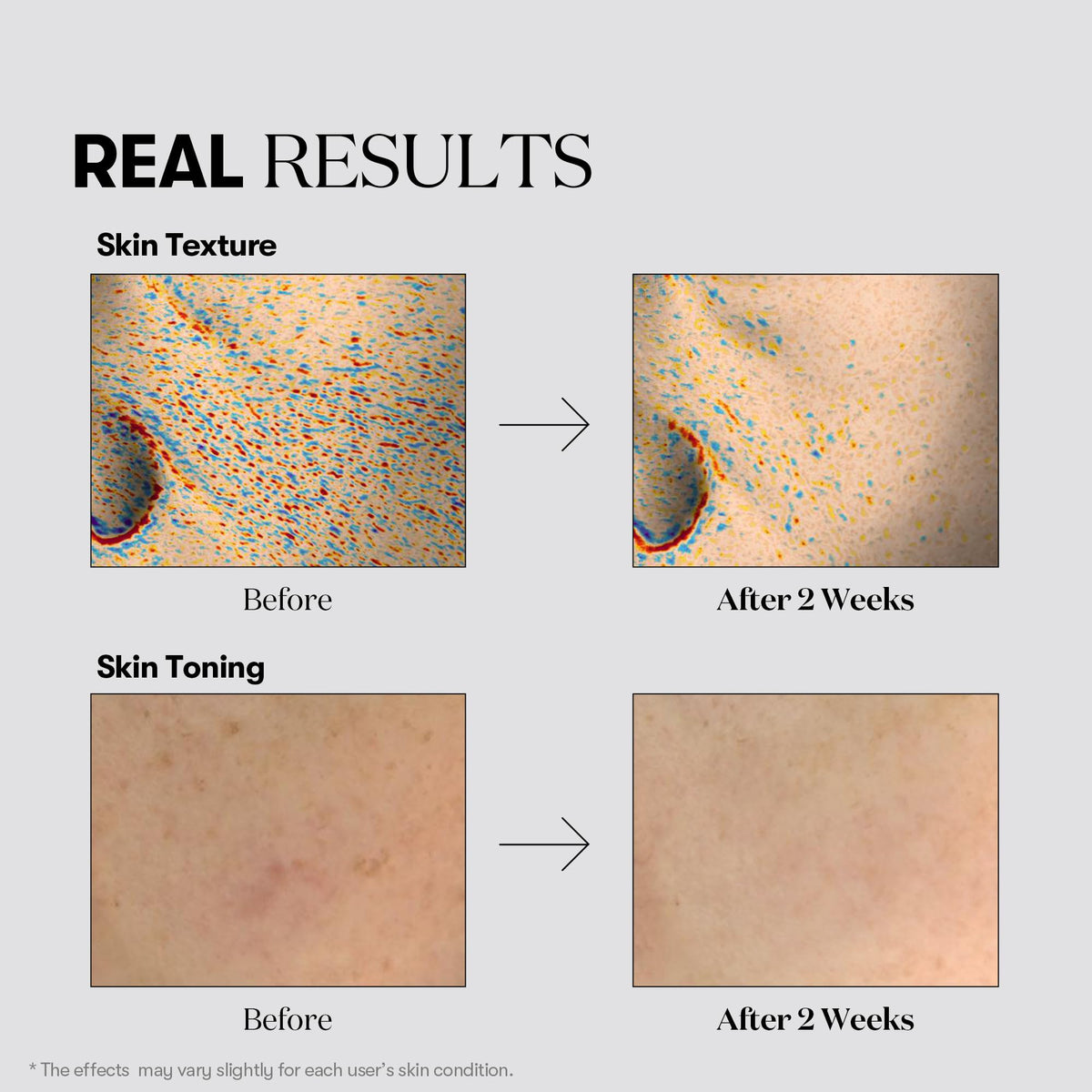 VT COSMETICS mask applied on model showing even coverage and calming effect