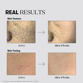VT COSMETICS mask applied on model showing even coverage and calming effect