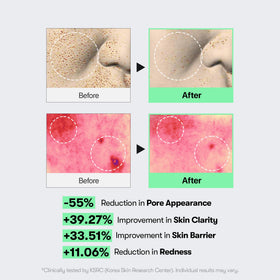 VT COSMETICS Reedle Shot applied to hand demonstrating lightweight absorption