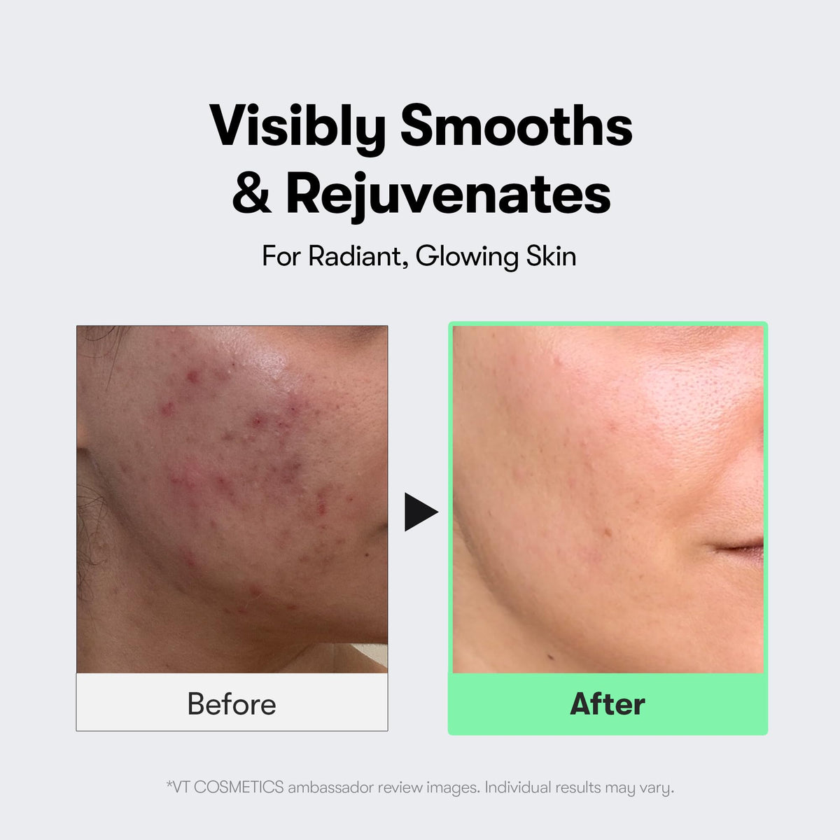 VT COSMETICS Reedle Shot label highlighting CICA and exosome ingredients