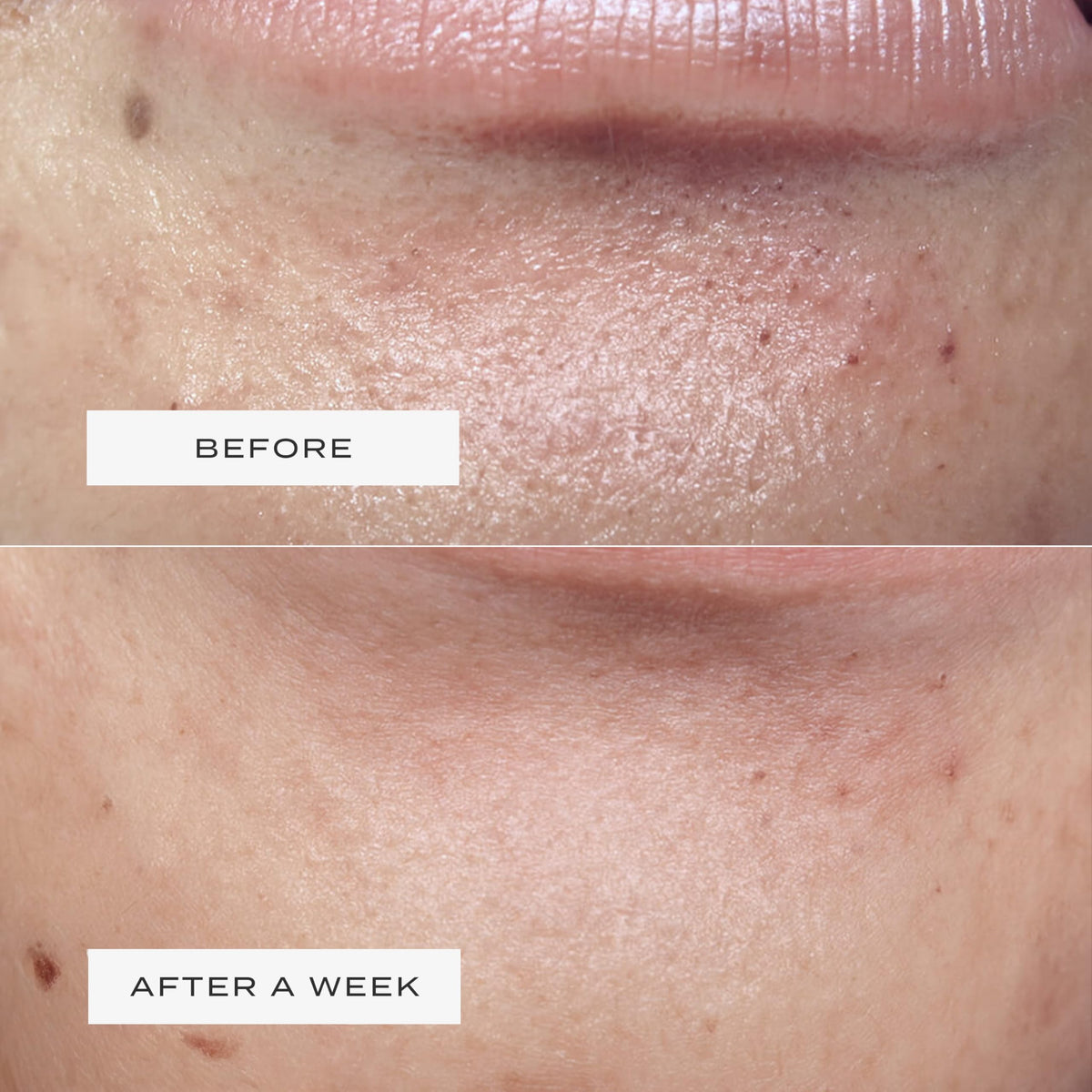 Vue hydrocolloid gel texture detail revealing absorbent surface for impurities