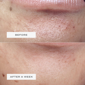 Vue hydrocolloid gel texture detail revealing absorbent surface for impurities