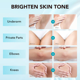 VZP being applied underarm demonstrating gentle brightening benefit