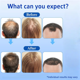 Wachinas application on scalp illustrating targeted delivery to thinning areas for convenience