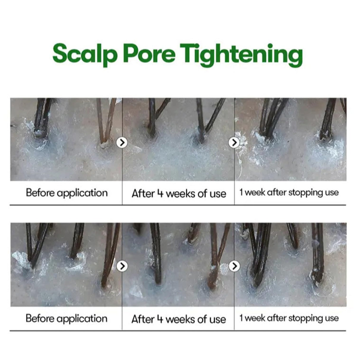 Water Ice Levin ampoule applied to scalp demonstrating targeted delivery
