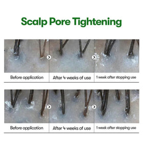 Water Ice Levin ampoule applied to scalp demonstrating targeted delivery