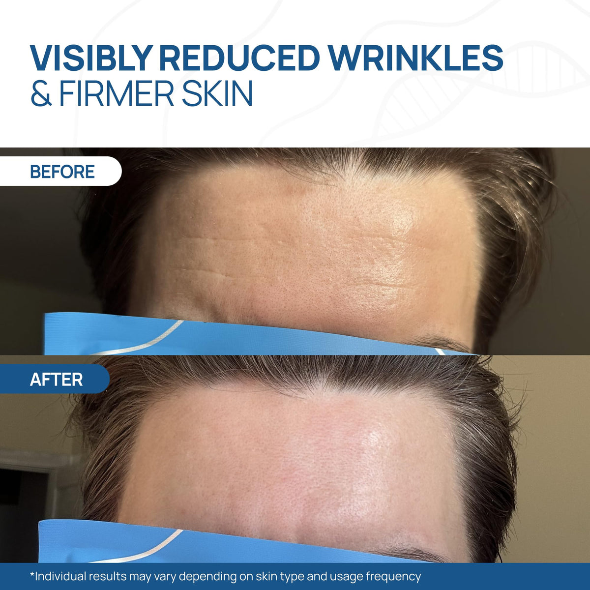 Welaroise transparent mask on skin indicating full absorption benefit