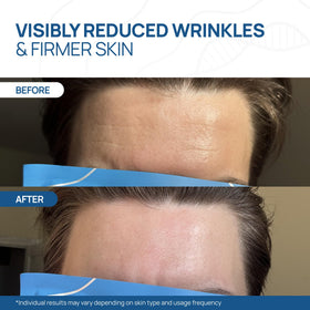 Welaroise transparent mask on skin indicating full absorption benefit