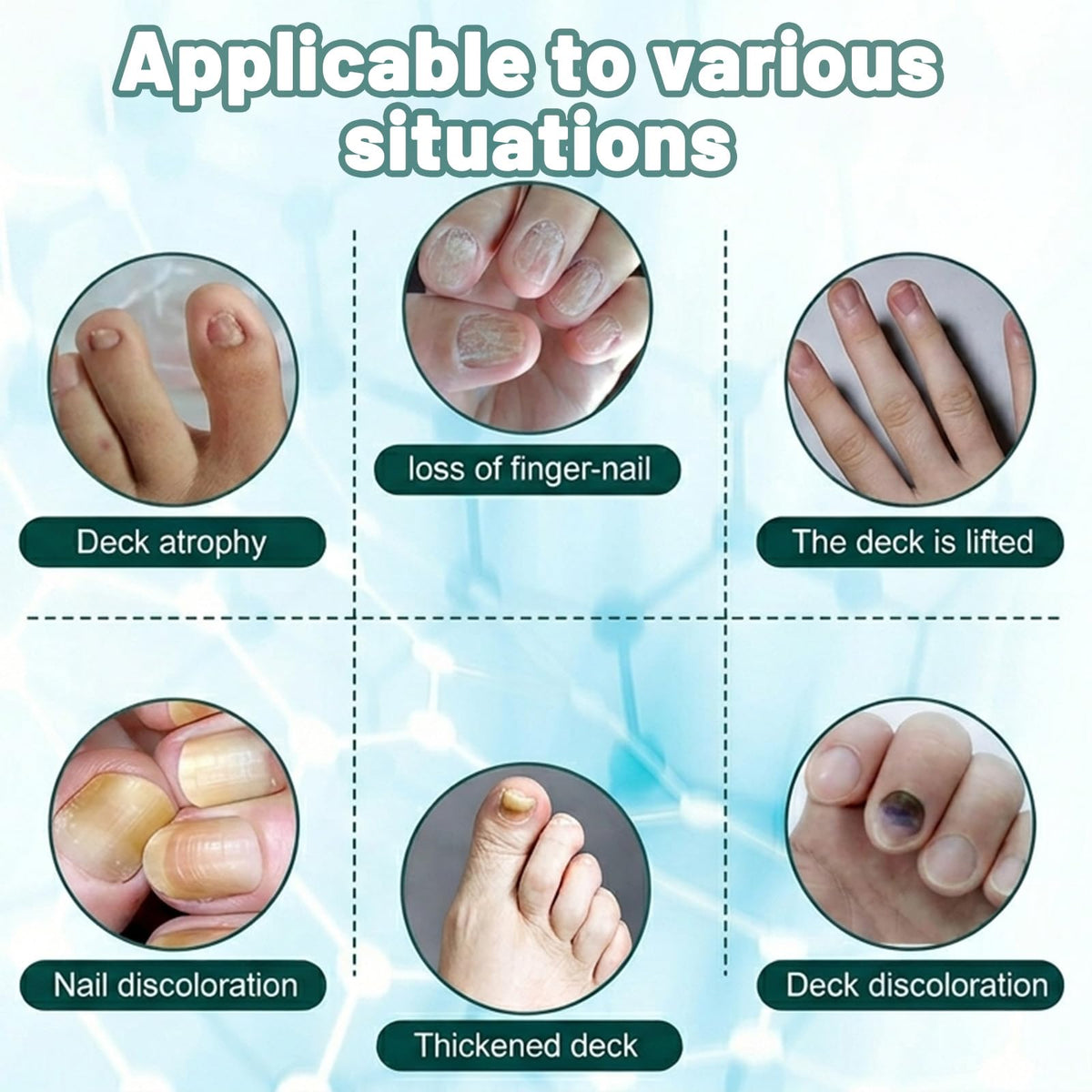 WellaNail before and after nails showing stronger, clearer results