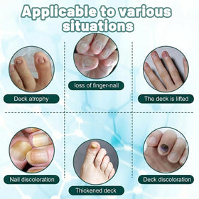 WellaNail before and after nails showing stronger, clearer results