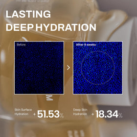Whamisa illustrative before and after showing refined pores benefit