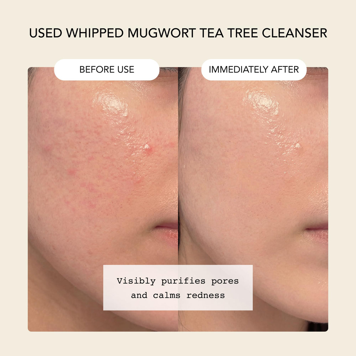 Whipped Semo Company mask spread on cheek showing quick 1–2 minute treatment