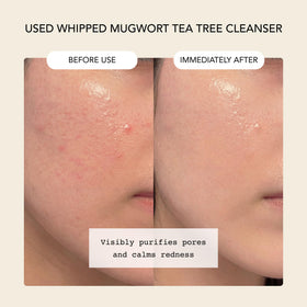 Whipped Semo Company mask spread on cheek showing quick 1–2 minute treatment