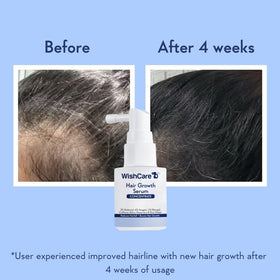 Applying WishCare serum to scalp demonstrating targeted application benefit