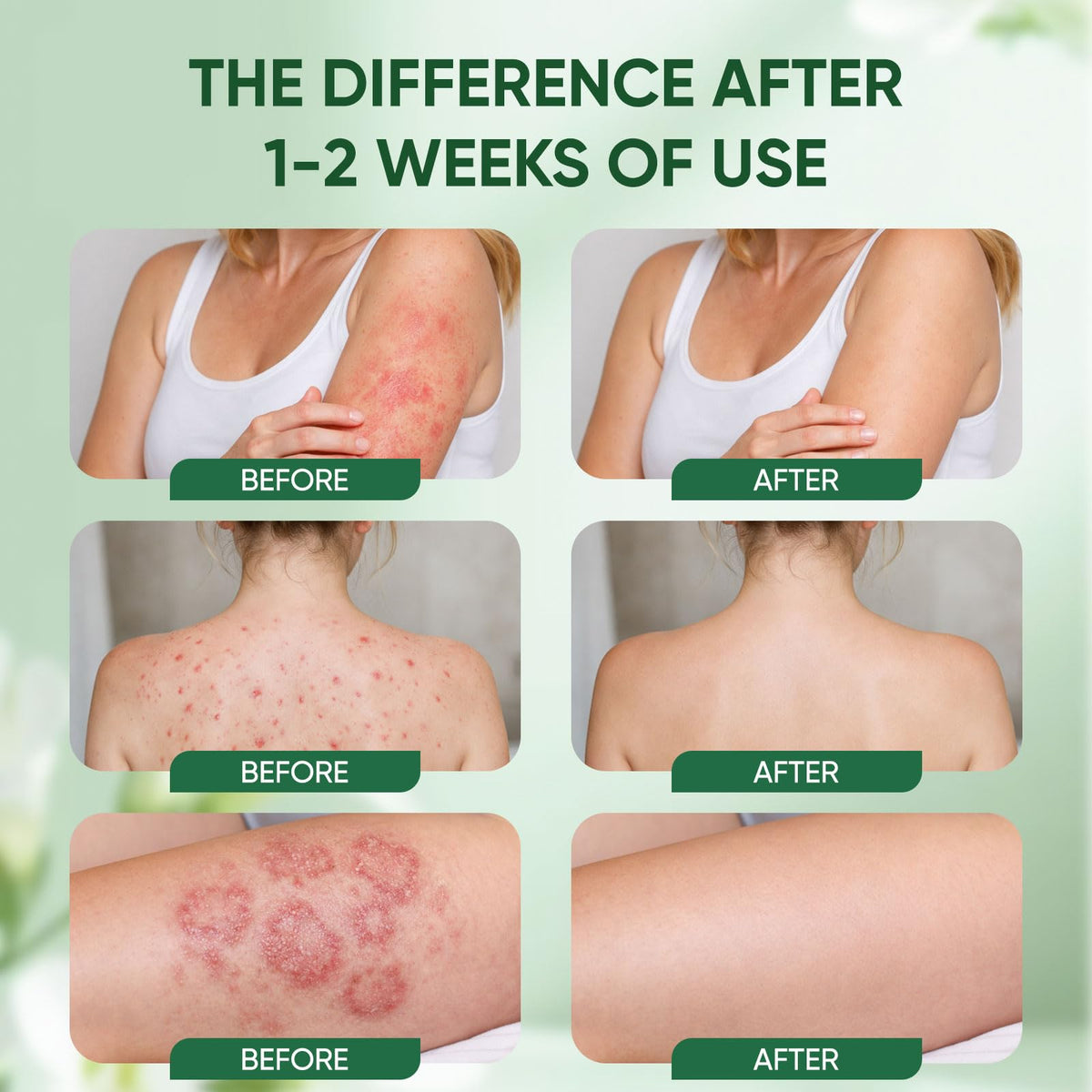 WNOHIQ Healora applied under breast illustrating moisture protection and reduced friction