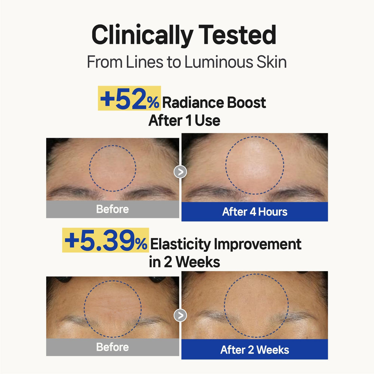 Wooshin Labottach patch applied to forehead during overnight use