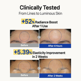 Wooshin Labottach patch applied to forehead during overnight use