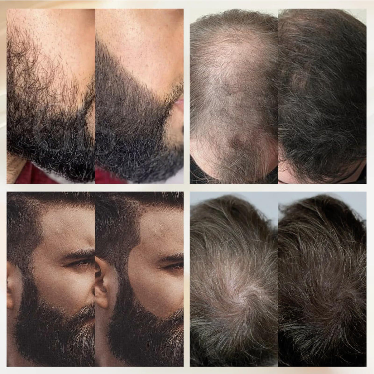 WOZUTUNT lifestyle image of groomed man showcasing enhanced beard confidence