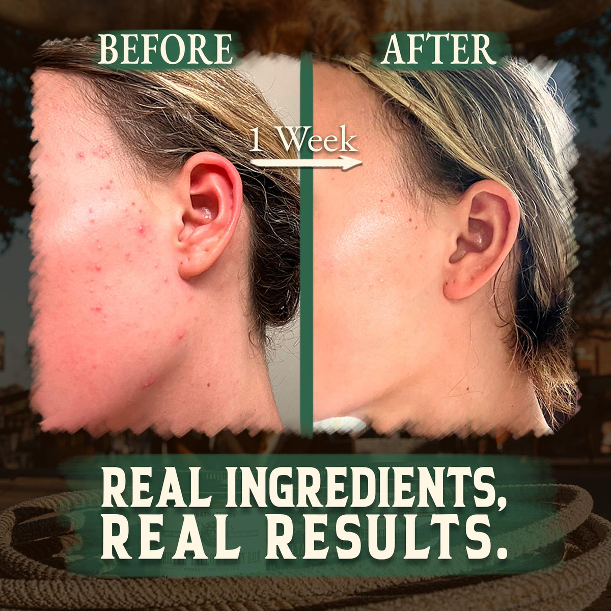 Wrath & Remedy applied on cheek demonstrating soothing hydration benefit