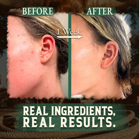 Wrath & Remedy applied on cheek demonstrating soothing hydration benefit