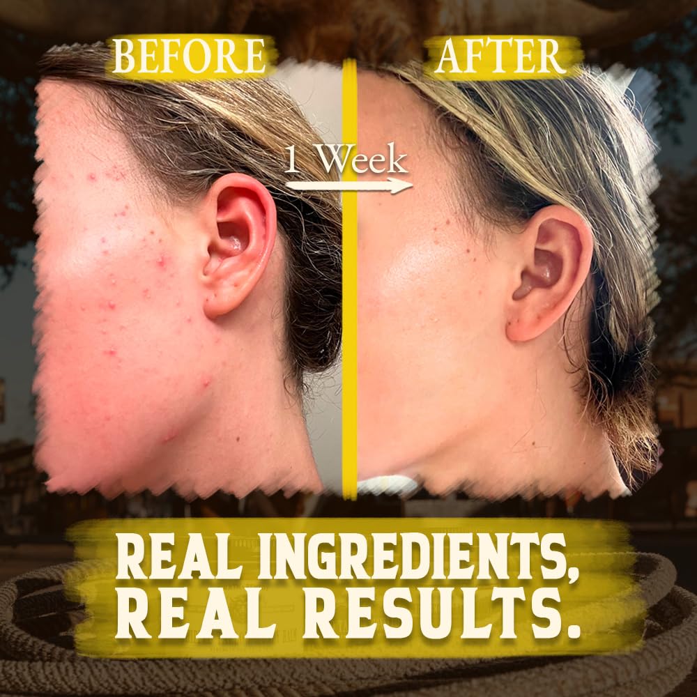 wrath & remedy open jar melting on fingertip demonstrating effortless application