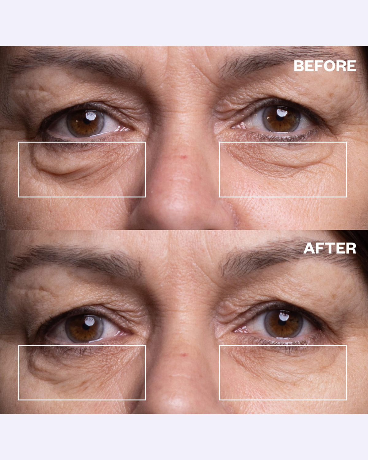 Wrinkles Schminkles applied under the eye demonstrating discreet coverage and immediate smoothing