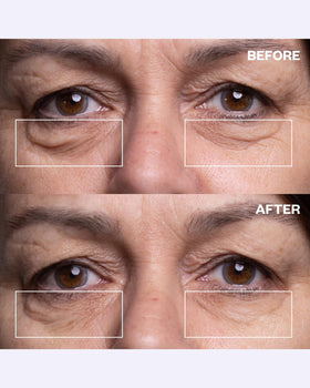 Wrinkles Schminkles applied under the eye demonstrating discreet coverage and immediate smoothing
