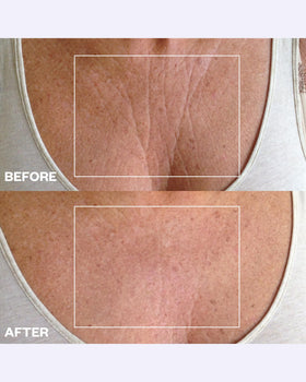 Wrinkles Schminkles chest patch detail demonstrating coverage area