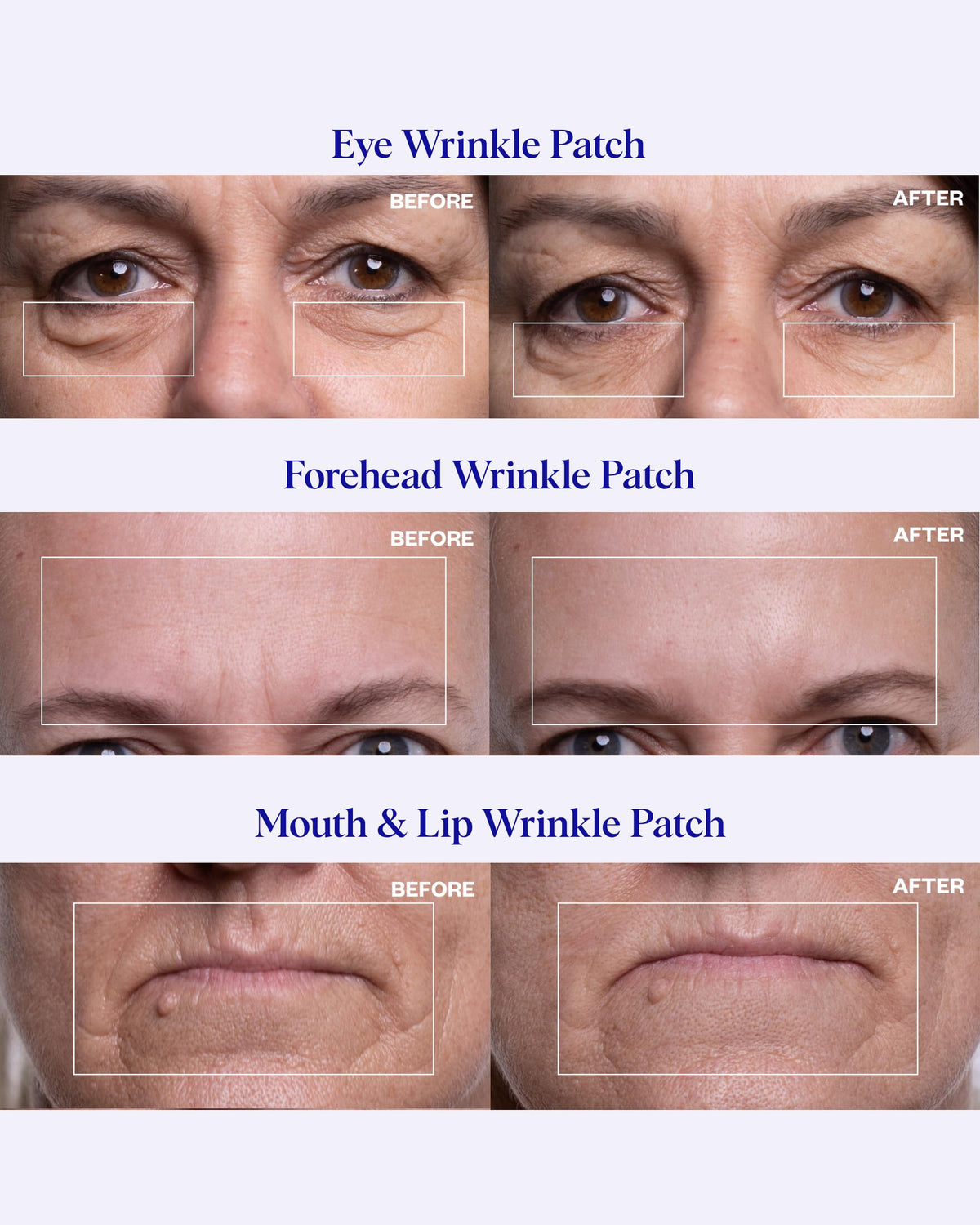 Wrinkles Schminkles eye patch detail showing contour fit to reduce crow’s feet