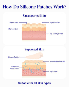 Wrinkles Schminkles patch in use on sleeping model for overnight smoothing