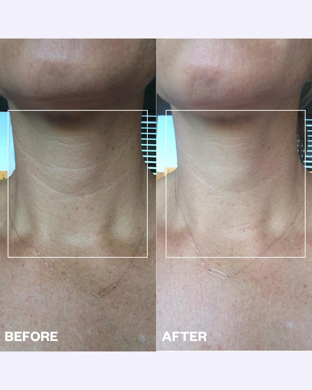 Wrinkles Schminkles silicone texture detail highlighting gentle hold