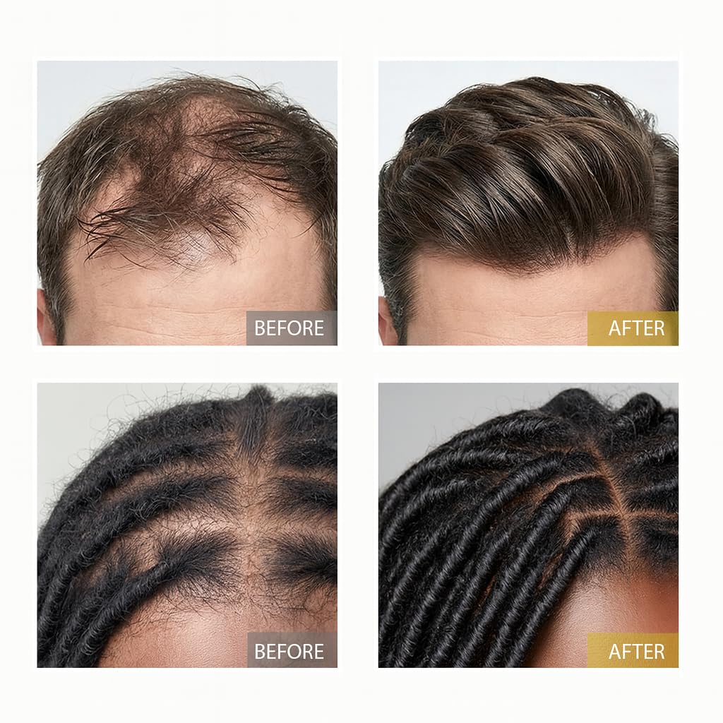 XILRVON before and after scale comparison showing fuller-looking hair results
