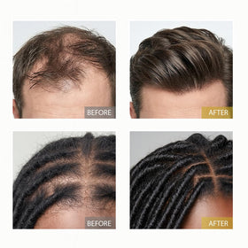 XILRVON before and after scale comparison showing fuller-looking hair results