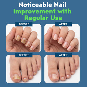 XILRVON using pen on cuticle demonstrating precise, controlled application