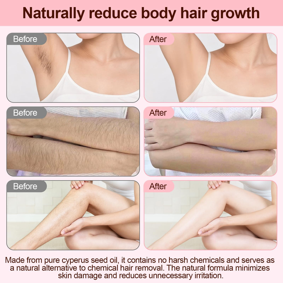 XINHAOLIN applied to underarm to soothe and hydrate skin