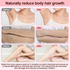 XINHAOLIN applied to underarm to soothe and hydrate skin