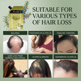 XUJECT shampoo bottle shown in shower to illustrate daily use and scalp-refreshing benefit