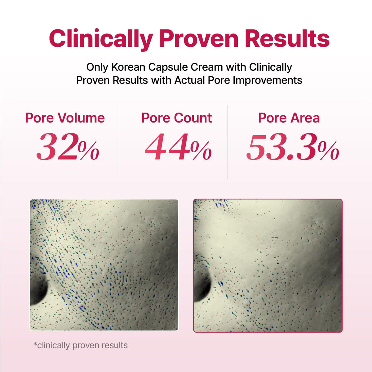 YADAH cream in hand being applied to skin showing smooth spread and comfort